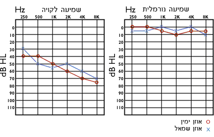אודיוגרמה