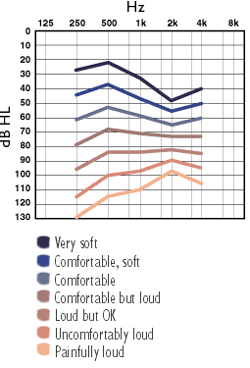 Loudness Scaling - הליך לקביעת העוצמה שבה קול מסוים נתפש על-ידי אדם