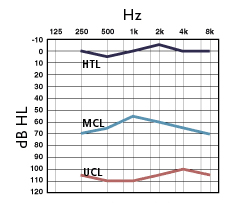 MCL - העוצמה שבה אדם מעדיף להקשיב לצליל מסוים במשך זמן ממושך